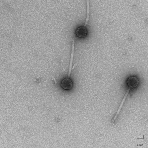 Mycobacteriophage BFree1 (100K x)
