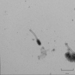 Mycobacteriophage Babsiella (60K x)