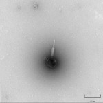Unidentified mycobacteriophage isolated in Micro 201 (60K x)