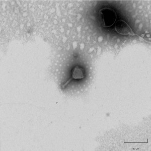 Unidentified mycobacteriophage isolated in Micro 201