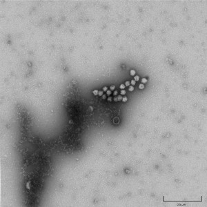 Pseudomonas bacteriophage Phi6 (mag = 30K x)