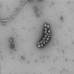 Pseudomonas bacteriophage Phi6 (mag = 60K x)